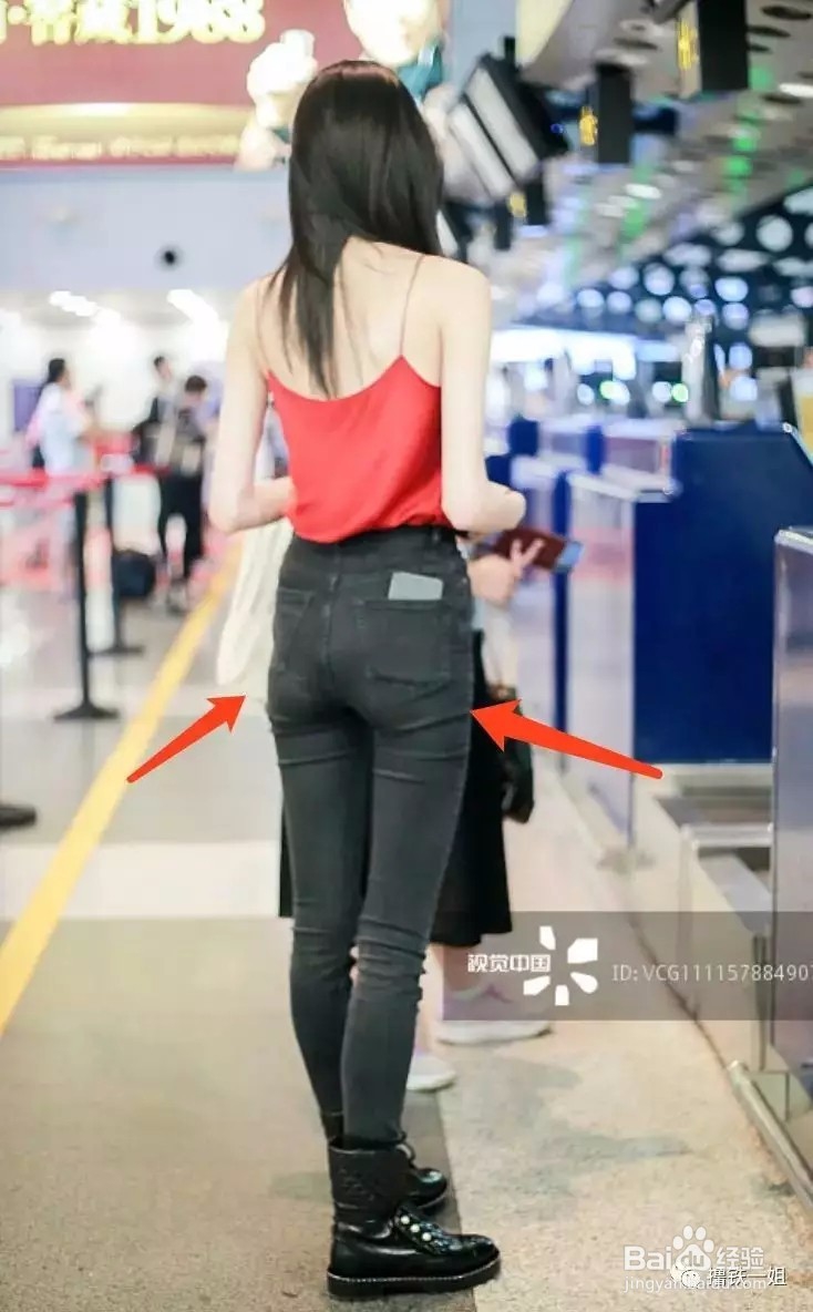 “死臀综合征”有救吗