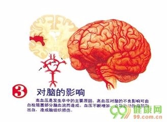 高血压的常见并发症你都了解吗