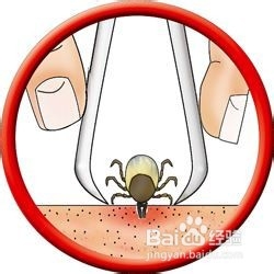 莱姆病是什么?如何预防莱姆病?