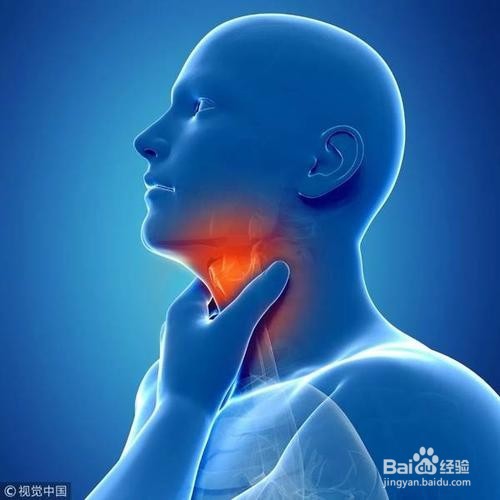 咽喉炎应注意些什么