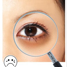 黑眼圈怎么缓解？