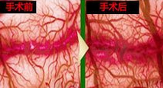 龟头很敏感怎么锻炼