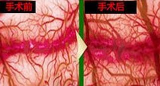 龟头很敏感怎么锻炼 百度经验
