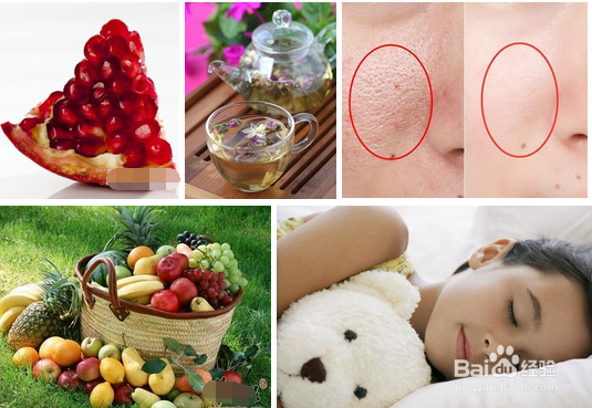 毛孔收缩方法有哪些