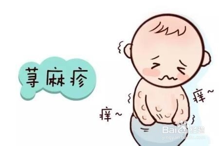 如何辨别宝宝出水痘？