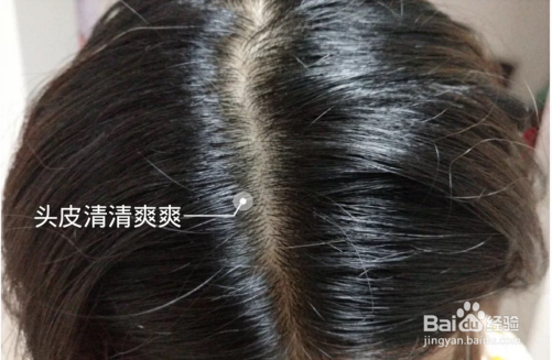 头皮痒用什么洗发水