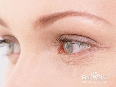 去眼袋手术失败及其修复方法 百度经验