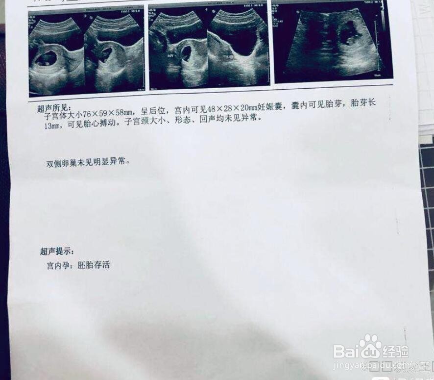 如何检查怀孕与否