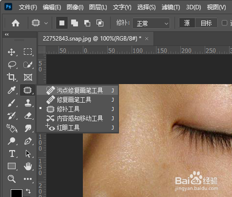 PS怎么P掉脸上的痣