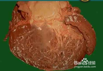 关于心肌疾病的临床图片。