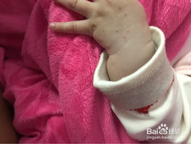 五个月宝宝不吃奶粉怎么办