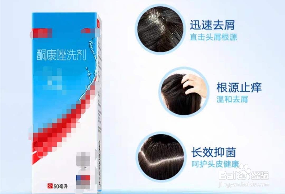 怎样选择去头屑的洗发水？