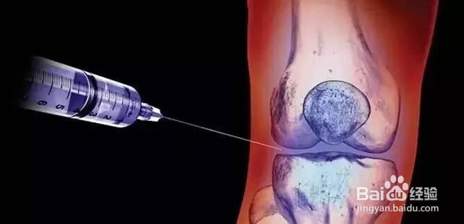 网球肘怎样治疗