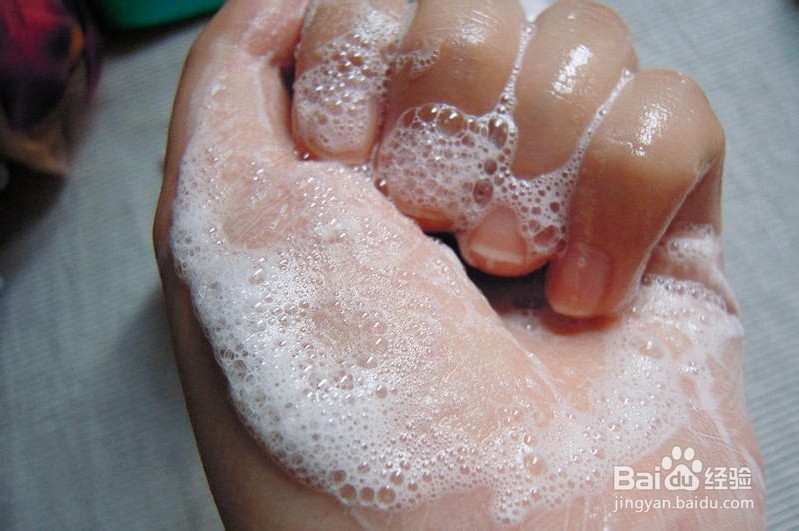 脸上长青春痘怎么办？