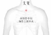 针灸减肥方法有哪些