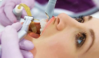 做了纯钛烤瓷牙后护理可以延长使用寿命