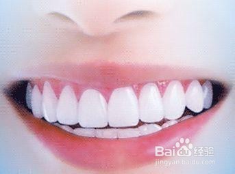 王小芳:关于牙齿你了解多少