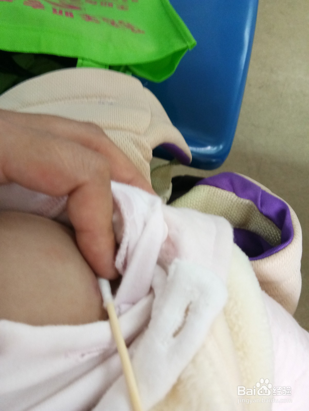 小孩打预防针要注意什么