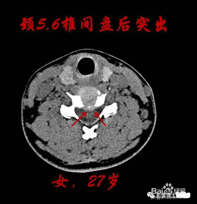 乳胶枕的好处 作用
