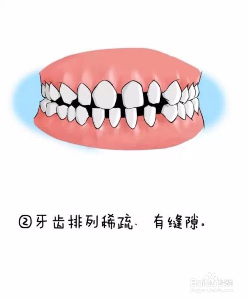 关于武汉牙齿矫正,我们需要知道的。。。