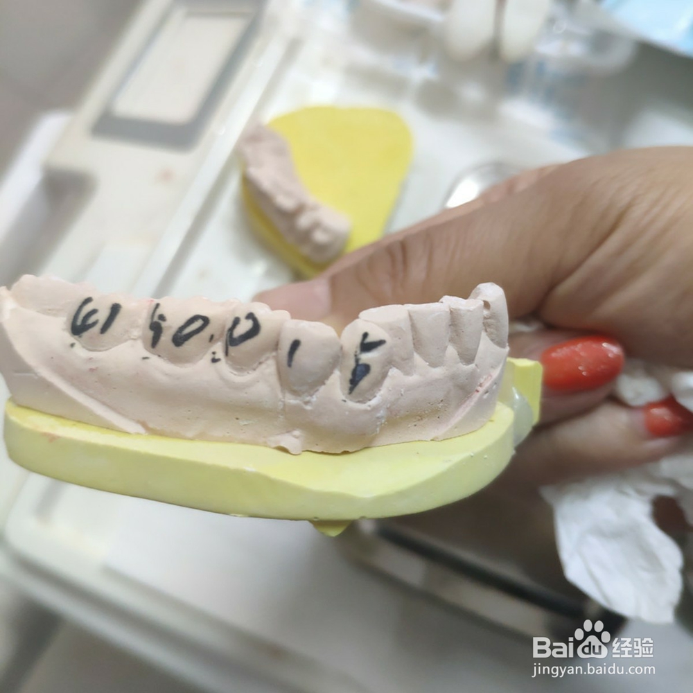 如何保护好我们的牙齿？