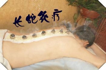 艾灸必须要知道的几个注意事项