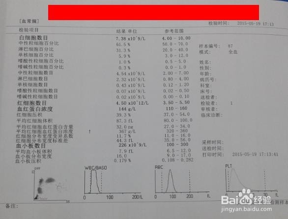 怎样用血常规检测仪