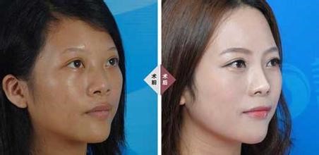 怎么让自个写的经历吸引他人的眼球