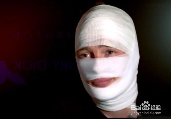 怎么预防花粉过敏？花粉过敏怎么办？防过敏偏方