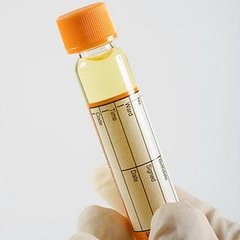 体检只需要做这些项目就够了