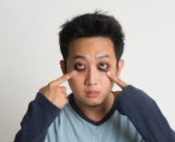 黑眼圈怎么去除