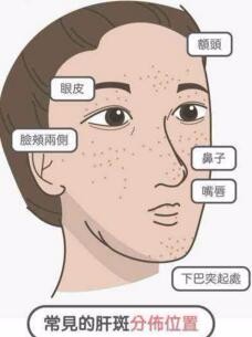 需要养肝的10个信号