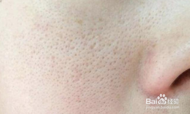 哪些坏习惯会导致毛孔越撑越大？