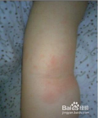 夏天怎么预防宝宝长痱子？