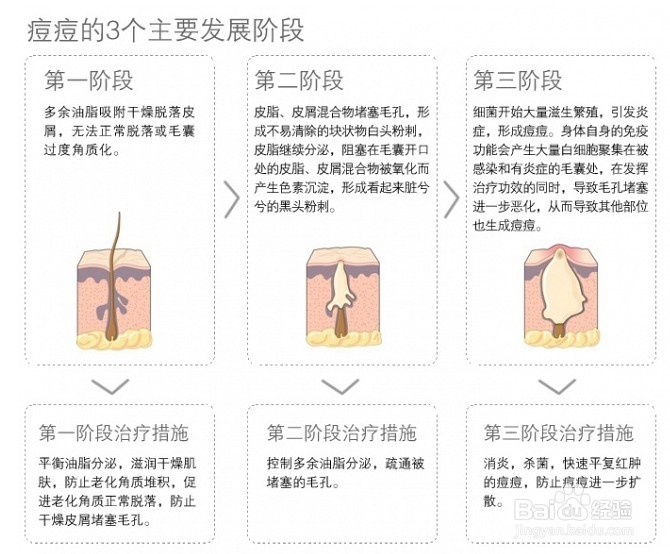 经常长痘痘怎么调理