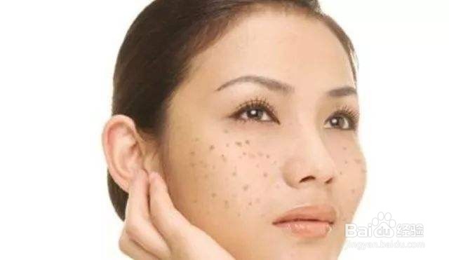 脸上长斑的祛斑方法