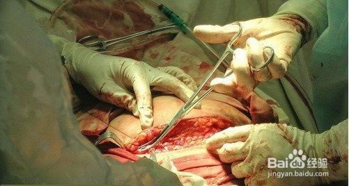 产后该怎么护理(个人心得)