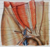 腹股沟区解剖的复习