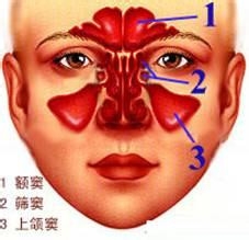 上颌窦炎治疗方法