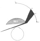 患有先天性白内障怎么办