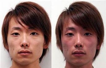 为什么喝酒脸会红