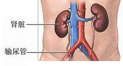 肾癌晚期寻求中医治疗方案