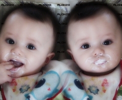 夏季婴儿剃光头有害怎么办