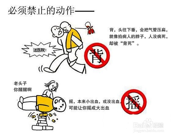 家庭急救：[1]中风的急救措施