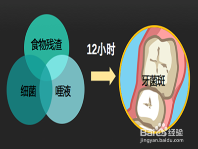 正确刷牙的方法