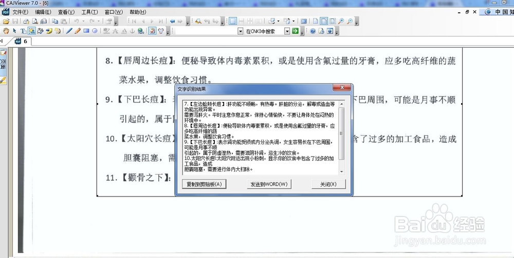 如何将图片转化成文字？
