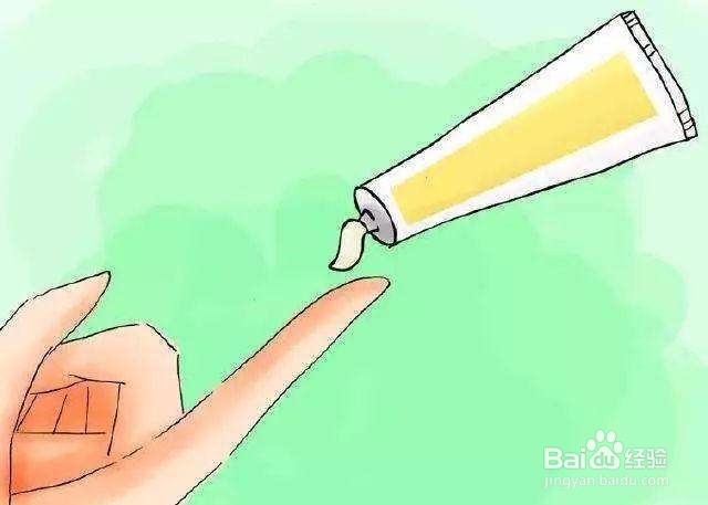 如何正确地面对银屑病?