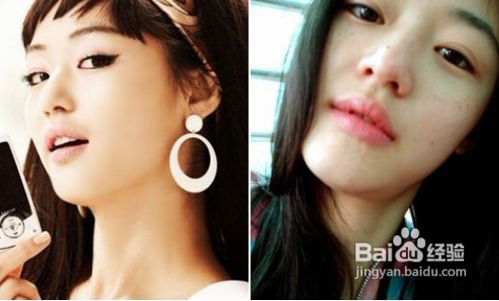 皮肤过敏怎样预防