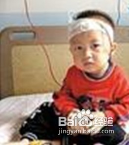 怎样预防地中海贫血