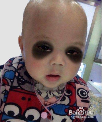 脸色变黑的11个原因分析,你在哪条中箭啦